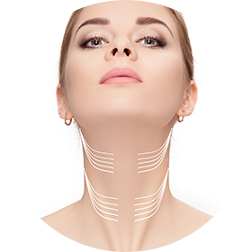 Chin contouring edmonton medi spa