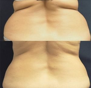 Lorem ipsum dolor sit amet, consectetur adipiscing elit, sed do eiusmod tempor incididunt ut labore et dolore magna aliqua.