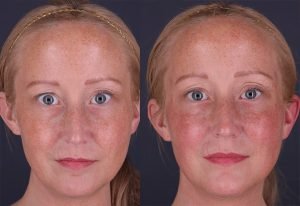 Lorem ipsum dolor sit amet, consectetur adipiscing elit, sed do eiusmod tempor incididunt ut labore et dolore magna aliqua.