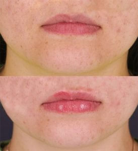 Lorem ipsum dolor sit amet, consectetur adipiscing elit, sed do eiusmod tempor incididunt ut labore et dolore magna aliqua.