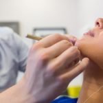 chin contouring sherwood park